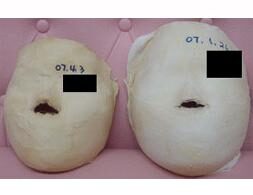 釜山店 管理前/20回管理后