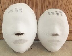 【缩小脸型管理】光州西区店 管理前 / 20次 管理后