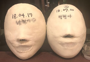 【对称脸型管理】仁川店 管理前 / 20次 管理后