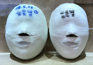 【缩小脸型管理】天安店 管理前 / 20次 管理后