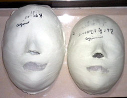 논현점 관리전 / 16회 관리후