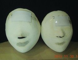 [작은얼굴]<br /> 강남역점 관리 전 / 20회 관리 후