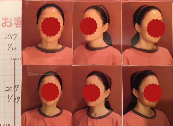 矯正と美容を同時に得られる薬手名家[非対称]プログラム