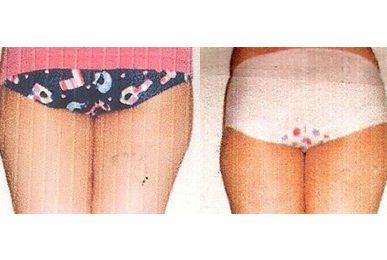 [] Daejeon b Before / after 20 sessions