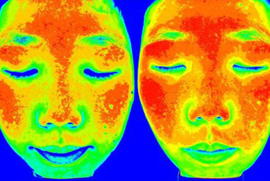 Chung** after 10 sessions