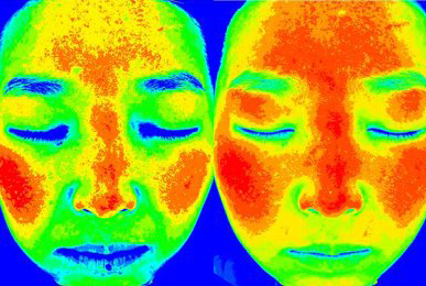 Kim** after 10 sessions