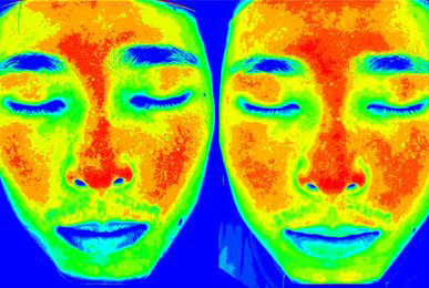 Kim** after 10 sessions