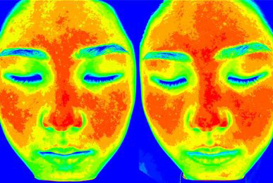 Kim** after 10 sessions