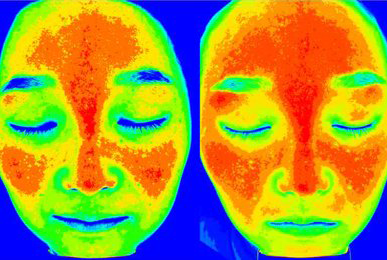 Kim** after 10 sessions