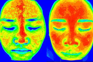 Kim ** after 10 sessions