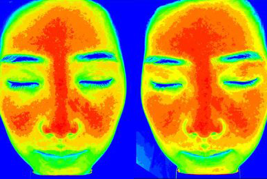 Chung** after 10 sessions