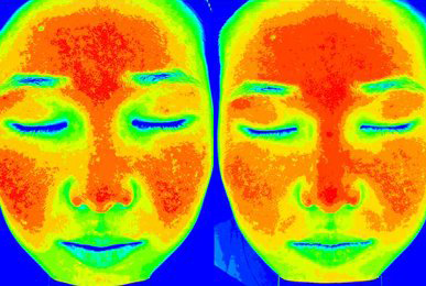 Kim** after 10 sessions
