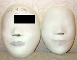 Cheonho Before / after 20 sessions