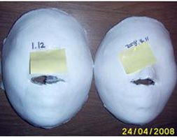 Suwon Before/ after 20 sessions