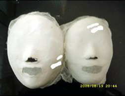 Sadang Before/ after 20 sessions