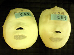 Seolleung A Before / after 20 sessions