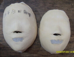 Seoul Suyu Before / after 20 sessions