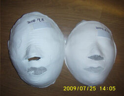 Suwon Before /after 10 sessions