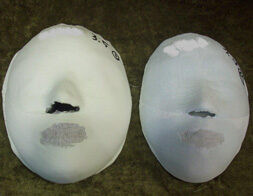 Guro Digital Before / after 20 sessions