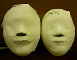 Yongin Jukjeon Before / after 10 sessions