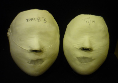Yeoksam Before / after 8 sessions