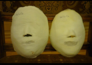 Yeoksam Before / after 8 sessions