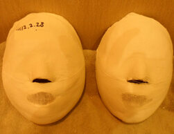 Guri Before and After 20 Sessions