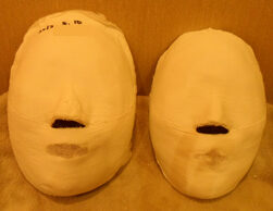 Guri Before and After 20 Sessions