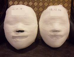 Busan Seomyeon Before and After 20 Sessions