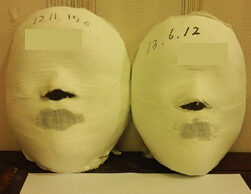 Changwon Before and After 20 Sessions