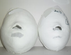 Cheongdam Before and After 20 Sessions