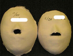 Yongin Before /after 20 sessions