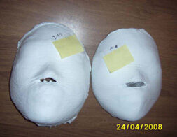 Suwon Branch: Before and after 20 sessions