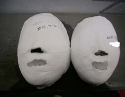 Bucheon Before / after 20 sessions