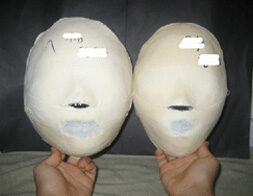 Seoul Suyu Before / after 20 sessions