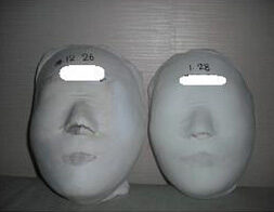 Yeonsinnae Before / after 10 sessions