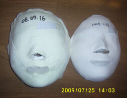 Suwon Before / after 16 sessions