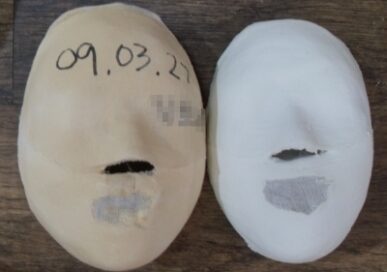 Seoul Suyu Before / after 20 sessions