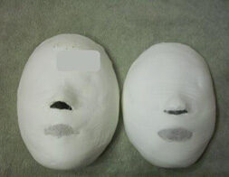 Guro Digital Complex Before / after 20 sessions