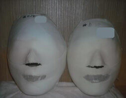 Yeonsinnae Before / after 10 sessions