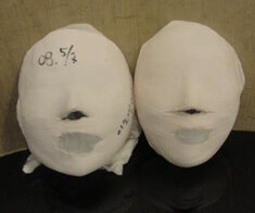Sadang Before / After 16 Sessions