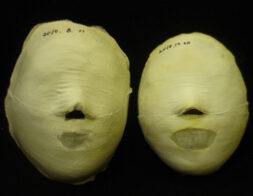 Yeoksam Before / After 8 Sessions