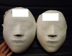 Gwangju Bongseongdong Before and After 20 Sessions