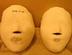 Guri Before and After 20 Sessions