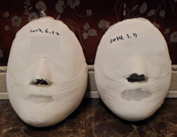 Myeongil Before and After 20 Sessions