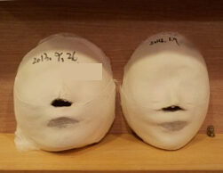 Yeonshinnae Before and After 20 Sessions