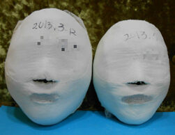 Nanyangju Hopyeong Before and After 10 Sessions