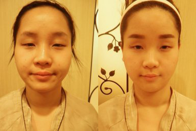Kim Hye-jin (Intensive Cheek