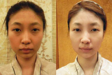 Kim Song-hee (Intensive Cheek)