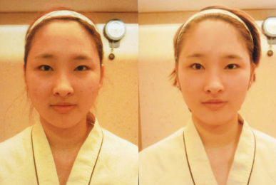 Sung U-ri (Intensive Cheek)
